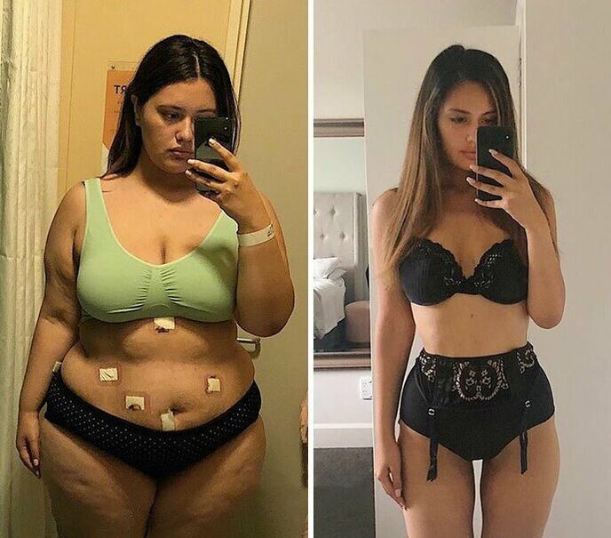 Meninas antes e depois da perda de peso com cápsulas KETO Complete